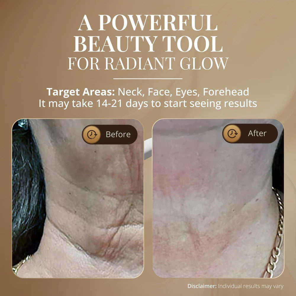 glo24k LED Beauty Device